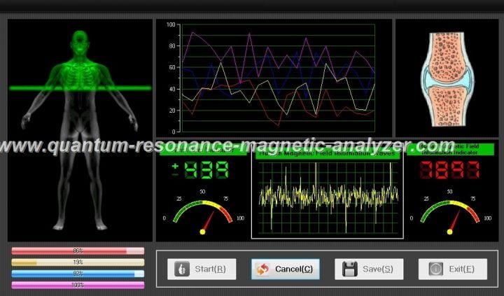 quantum resonance magnetic analyzer 11